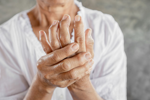 patient with gout showing hands with deformities