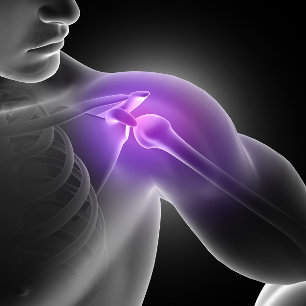 Shoulder Impingement Syndrome: Causes, Symptoms & Treatment Explained ...