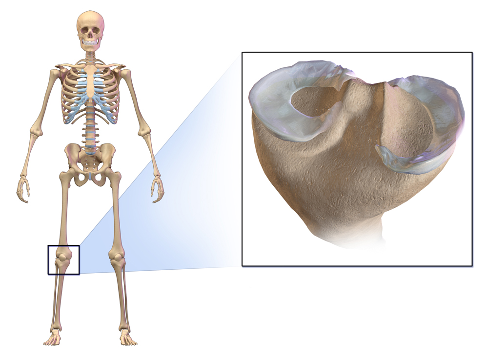 A diagram of knee showing the placement and shape of the meniscus